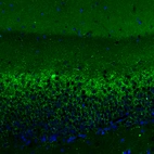 Immunofluorescence staining of rat hippocampus shows moderate positivity in glutamatergic fibers in granular cell layer of the dentate gyrus.