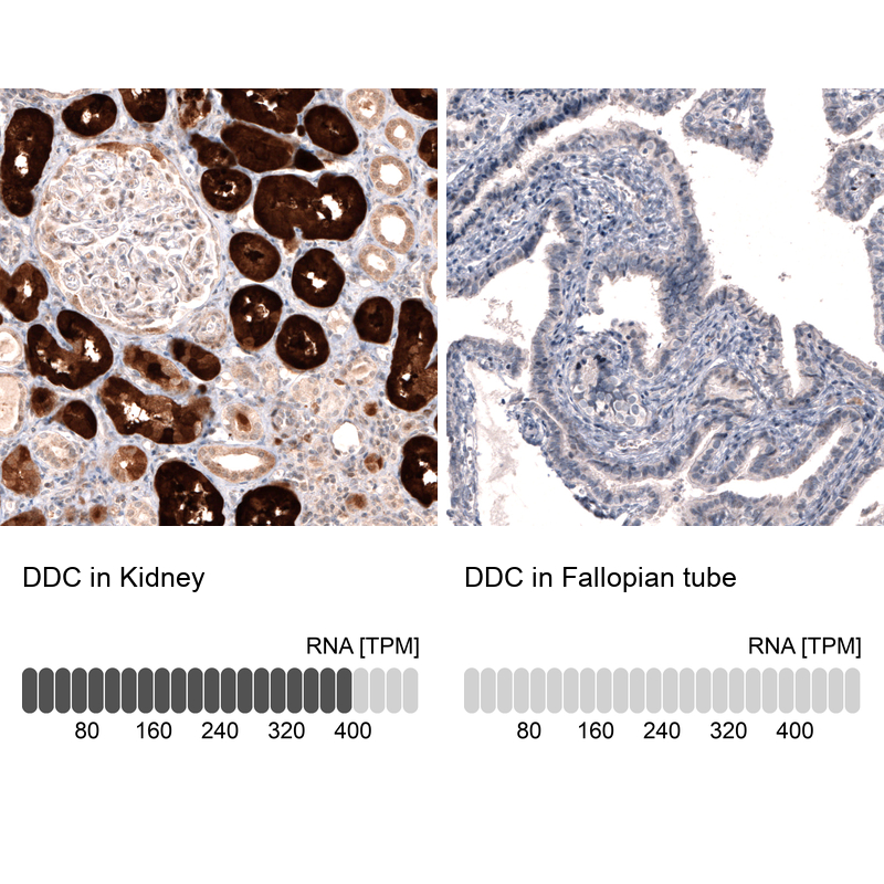 Anti-DDC Recombinant Antibody