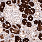 Immunohistochemical staining of human kidney shows strong cytoplasmic positivity in cells in tubules.