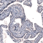 Immunohistochemical staining of human fallopian tube shows no positivity in glandular cells as expected.