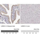 Anti-LAMC2 Recombinant Antibody