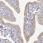 Immunohistochemical staining of human fallopian tube shows moderate positivity in basement membrane of glandular cells.