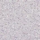 Immunohistochemical staining of human liver shows no positivity in hepatocytes as expected.