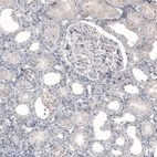 Immunohistochemical staining of human kidney shows no positivity in cells in tubules or glomeruli as expected.