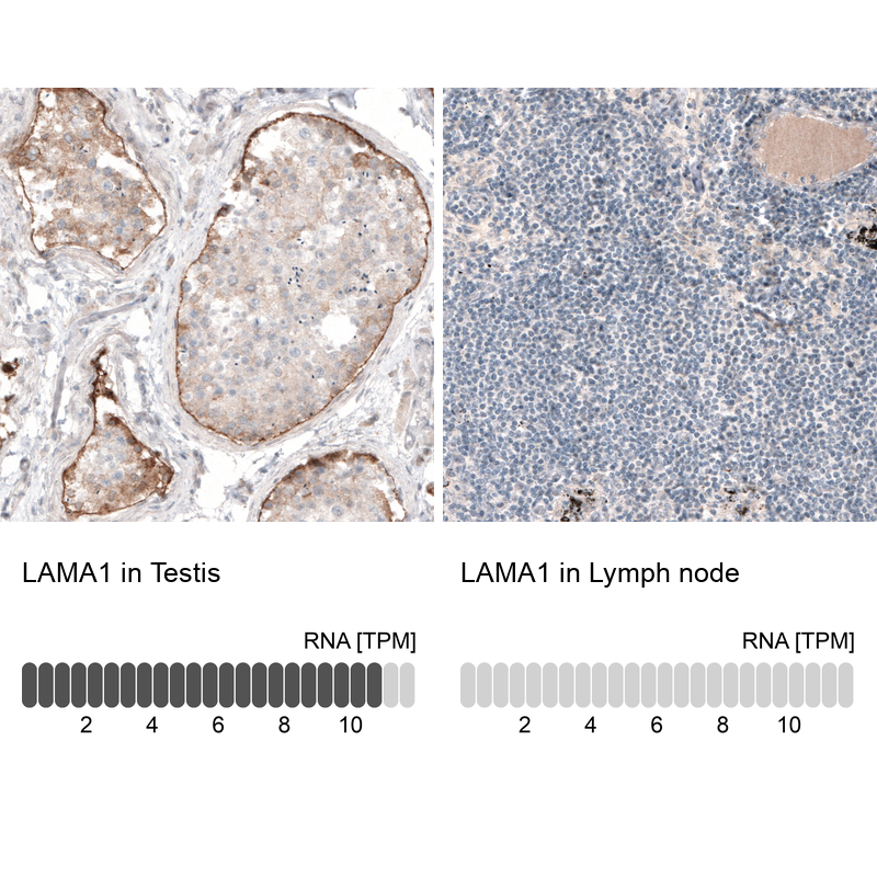 Anti-LAMA1 Recombinant Antibody