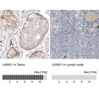 Anti-LAMA1 Recombinant Antibody