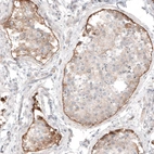 Immunohistochemical staining of human testis shows moderate positivity in basement membrane of cells in seminiferous ducts.