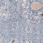 Immunohistochemical staining of human lymph node shows no positivity in lymphoid cells as expected.