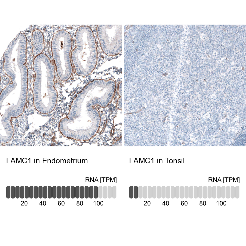 Anti-LAMC1 Recombinant Antibody