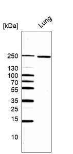 Western blot analysis in human lung tissue.