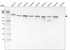 Western blot analysis of purified human recombinant Laminin-111, Laminin-121, Laminin-211, protein Laminin-221, Laminin-411, Laminin-421, Laminin-511, Laminin-521 and Laminin-332.