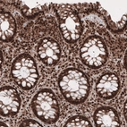 Immunohistochemical staining of human rectum shows strong cytoplasmic and nuclear positivity in glandular and connective tissue cells.