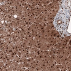 Immunohistochemical staining of human liver shows strong cytoplasmic and nuclear immunoreactivity in hepatocytes.