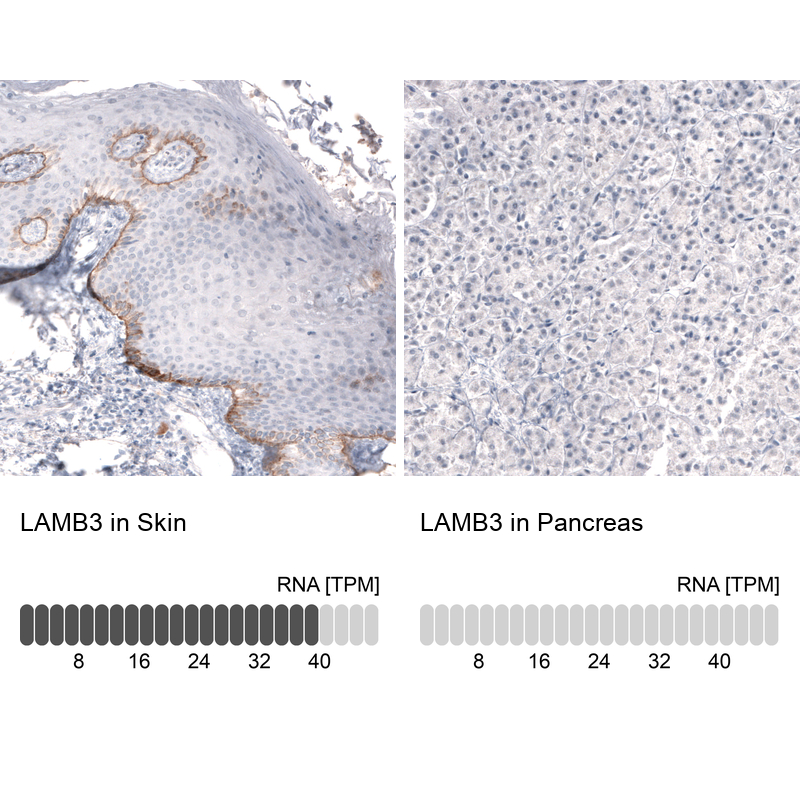 Anti-LAMB3 Recombinant Antibody