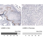 Anti-LAMB3 Recombinant Antibody