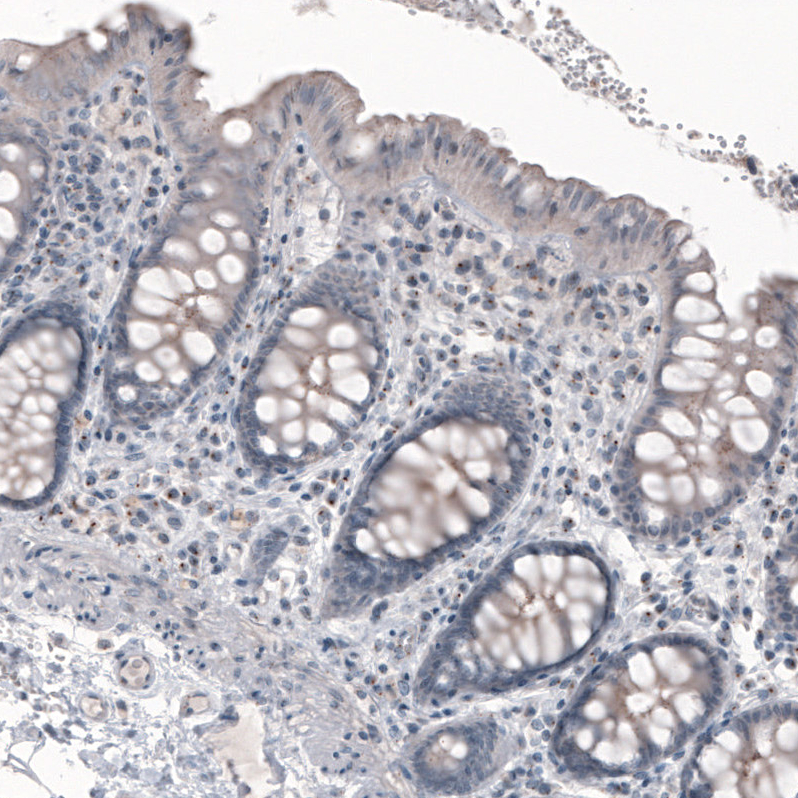 Anti-CEP350 Recombinant Antibody