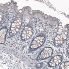 Anti-CEP350 Recombinant Antibody