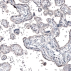 Immunohistochemical staining of human placenta shows centrosome-like immunoreactivity in trophoblast cells.