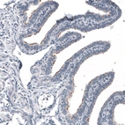 Immunohistochemical staining of human fallopian tube shows moderate positivity in the basal bodies of cilia in glandular cells.