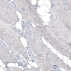 Immunohistochemical staining of human skeletal muscle shows no positivity in myocytes as expected.