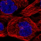 Immunofluorescence staining of A431 cells using the anti-CEP350 monoclonal antibody, showing specific staining of the centrosome in green. Microtubule- and nuclear probes are visualized in red and blue, respectively (where available).