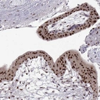 Immunohistochemical staining of human placenta shows strong nuclear positivity in trophoblastic cells.