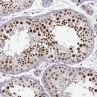 Immunohistochemical staining of human testis shows strong nuclear positivity in cells in seminiferous ducts.