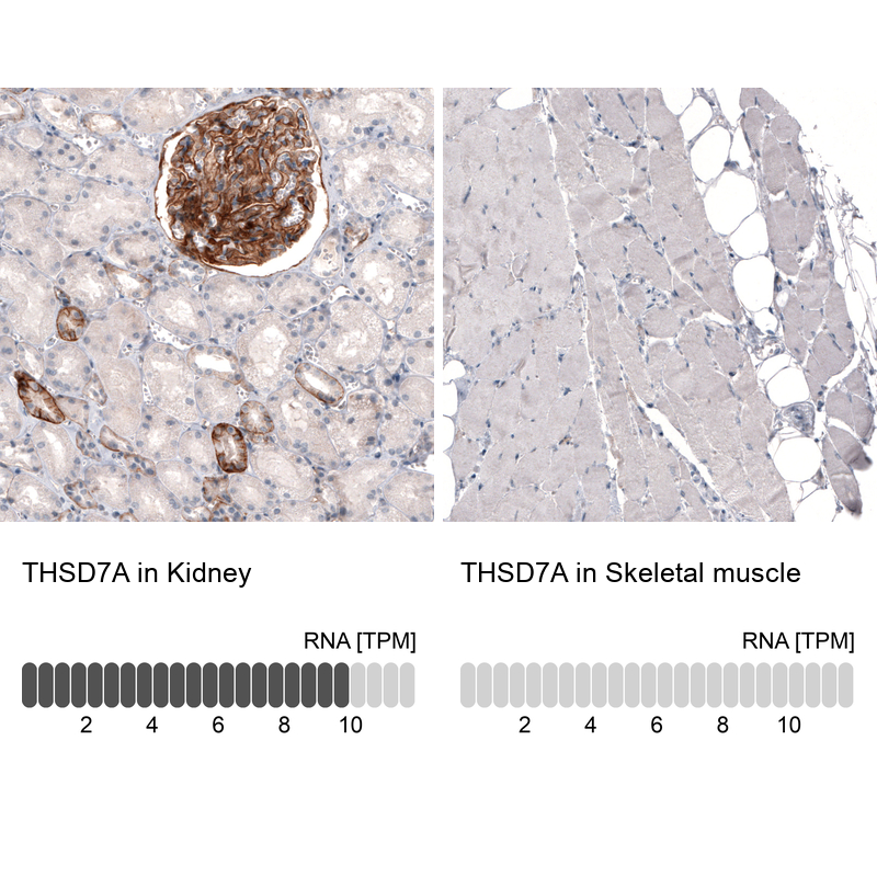 Anti-THSD7A Recombinant Antibody