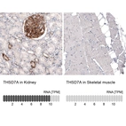 Anti-THSD7A Recombinant Antibody