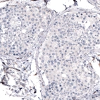 Immunohistochemical staining of human testis shows no positivity in cells in seminiferous ducts as expected.