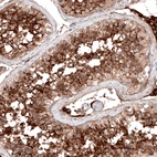 Immunohistochemical staining of human testis shows strong membranous positivity in cells in seminiferous ducts.