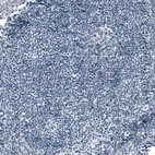 Immunohistochemical staining of human tonsil shows no positivity in non-germinal center cells as expected.