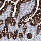 Immunohistochemical staining of human small intestine shows strong granular cytoplasmic positivity in glandular cells.