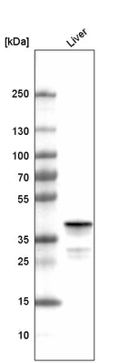 Western blot analysis in human liver tissue.