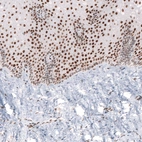 Immunohistochemical staining of human uterine cervix shows strong nuclear positivity in epithelial cells.