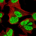 Immunofluorescence staining of SH-SY5Y cells using the Anti-CUX1 monoclonal antibody, showing specific staining in the nucleoplasm in green. Microtubule- and nuclear probes are visualized in red and blue, respectively (where available).