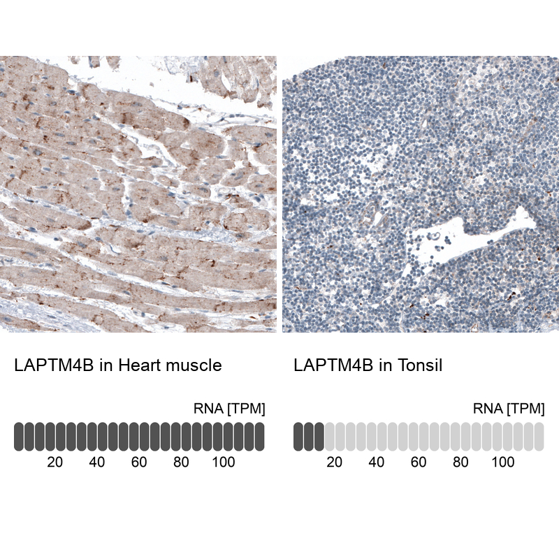 Anti-LAPTM4B Recombinant Antibody