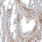 Immunohistochemical staining of human prostate shows moderate cytoplasmic positivity in smooth muscle cells.
