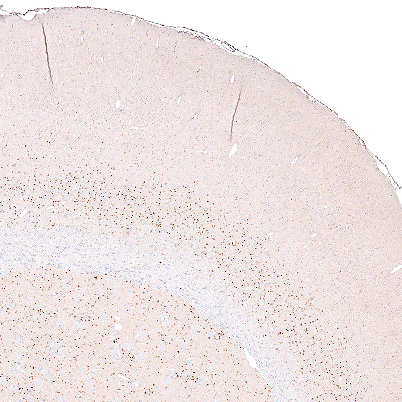 Anti-FOXP2 Recombinant Antibody