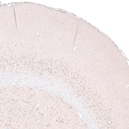 Anti-FOXP2 Recombinant Antibody