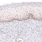Immunohistochemical staining of human uterine cervix shows moderate to strong nuclear positivity in squamous epithelial cells.