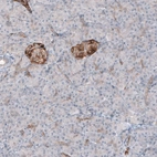 Immunohistochemical staining of human pancreas shows cytoplasmic immunoreactivity in pancreatic islets.