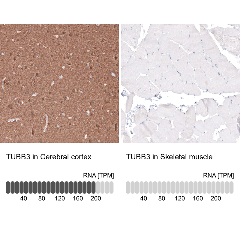 Anti-TUBB3 Recombinant Antibody