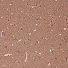 Immunohistochemical staining of human cerebral cortex shows strong positivity in neurons and neuropil.