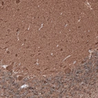 Immunohistochemical staining of human cerebellum shows strong positivity in neurons and neuropil.