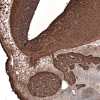 Immunohistochemical staining of mouse embryo E11 shows strong positivity in the developing central and peripheral nervous system.