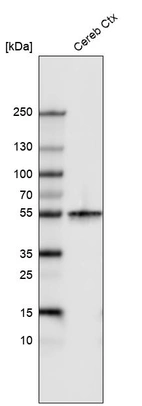 Western blot analysis in human cerebral cortex tissue.