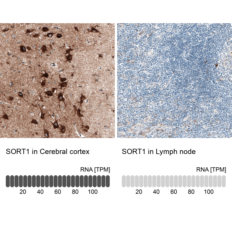Anti-SORT1 Recombinant Antibody
