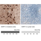 Anti-SORT1 Recombinant Antibody