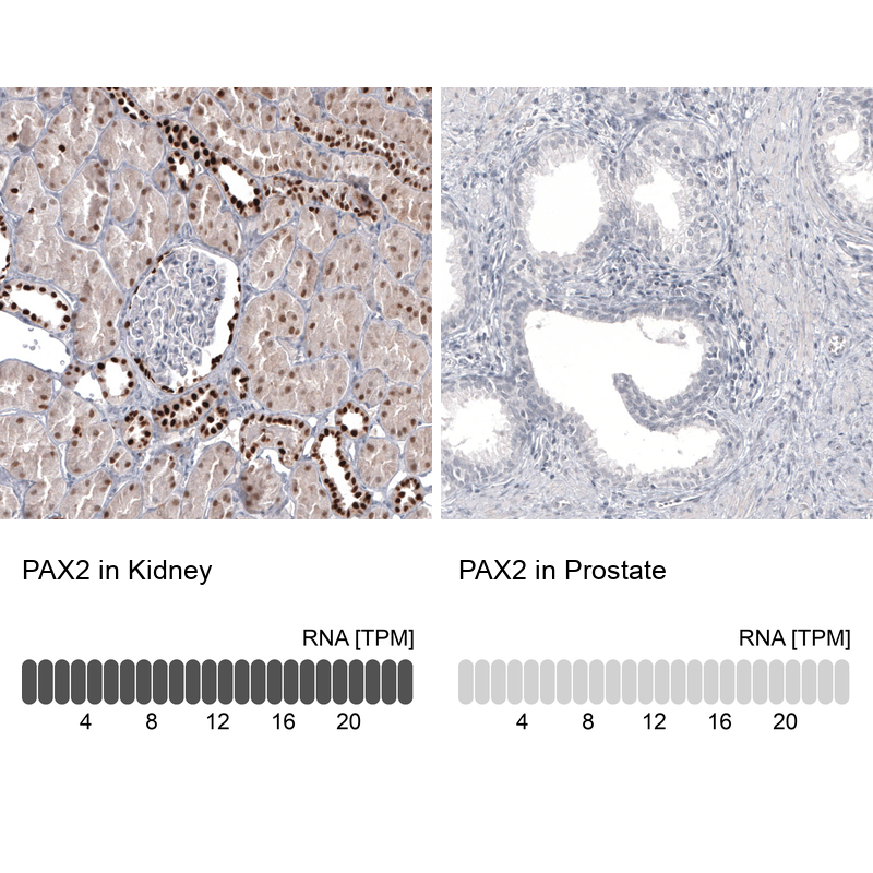 Anti-PAX2 Recombinant Antibody